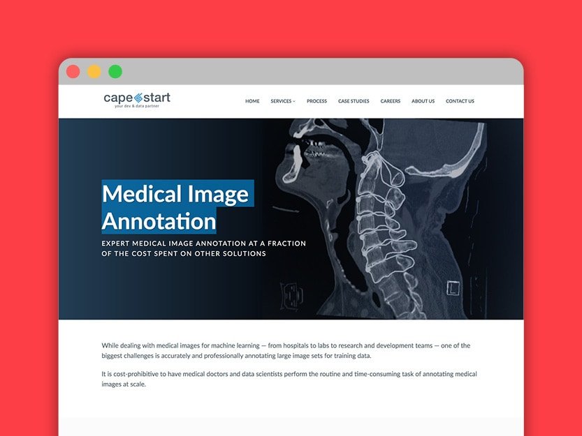 Portfolio Icons - Other Writing - CapeStart - Medical Image Annotation